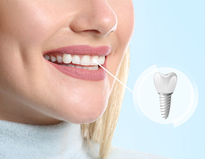 Family Dentist in Springfield GA